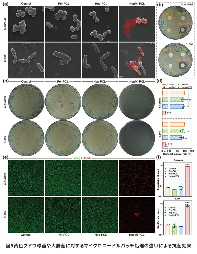 図5黄色ブドウ球菌や大腸菌に対するマイクロニードルパッチ処理の違いによる抗菌効果