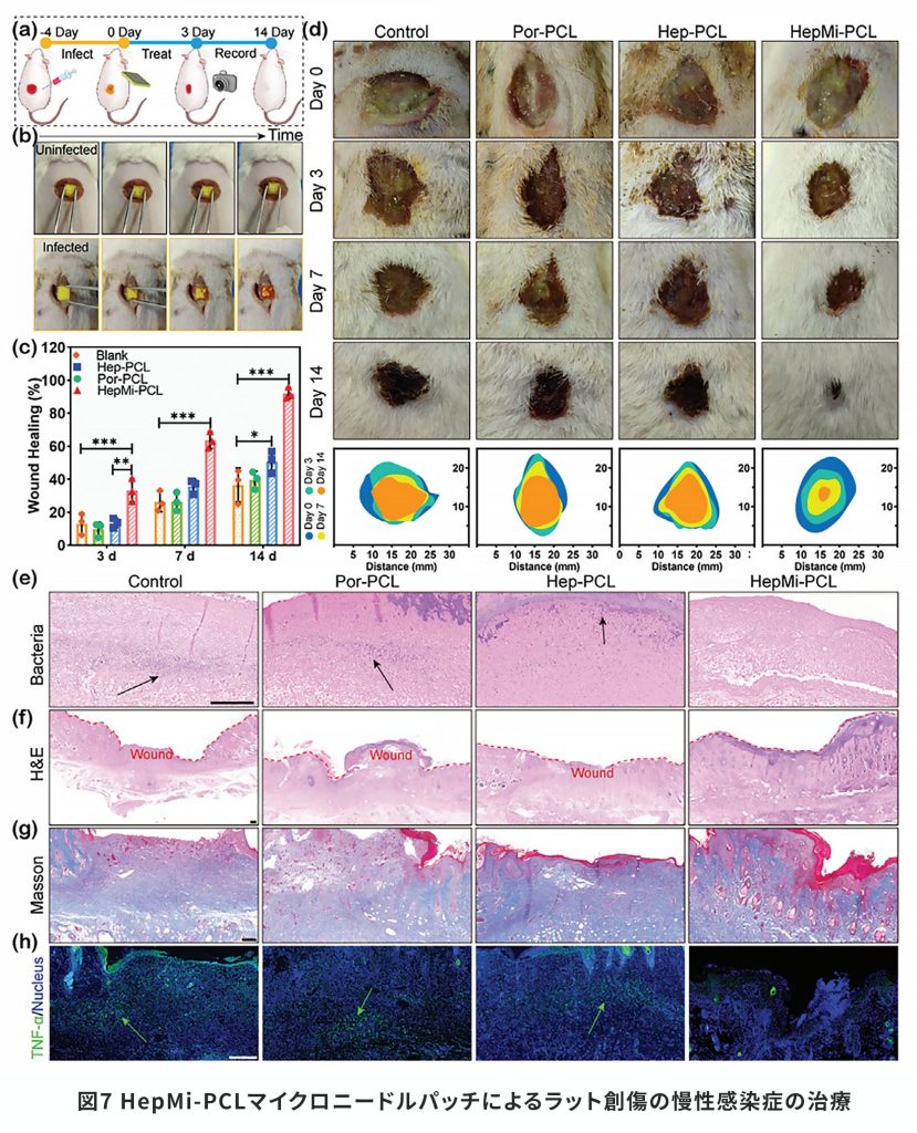 図7 HepMi-PCLマイクロニードルパッチによるラット創傷の慢性感染症の治療