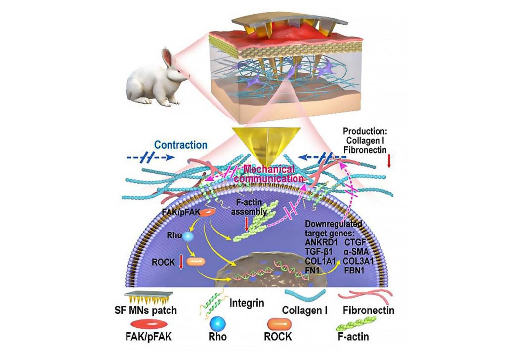 図4 マイクロニードルによる線維芽細胞や細胞外マトリックス相互作用のメカニズム