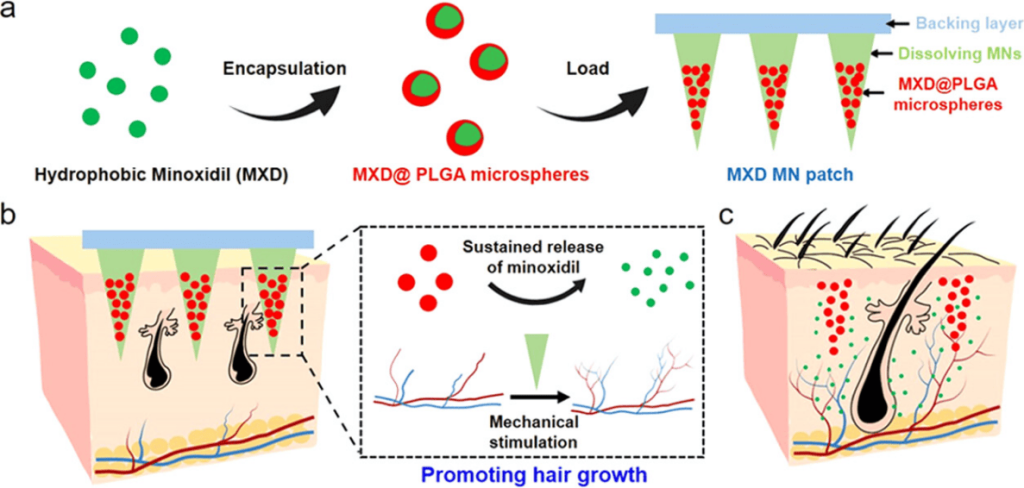 図8 男性型脱毛症（AGA）治療のためのMXDマイクロニードルパッチの概略図
